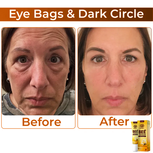 Frendorf | BeeVenom- Augencreme Mit Bienengift Für Strahlende Jugendlichkeit