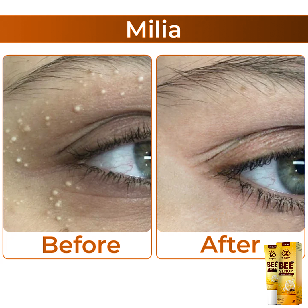 Frendorf | BeeVenom- Augencreme Mit Bienengift Für Strahlende Jugendlichkeit