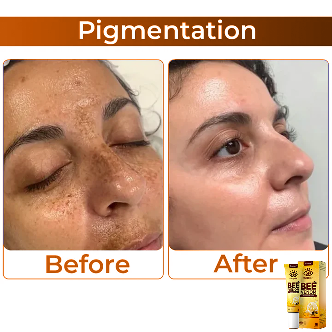Frendorf | BeeVenom- Augencreme Mit Bienengift Für Strahlende Jugendlichkeit