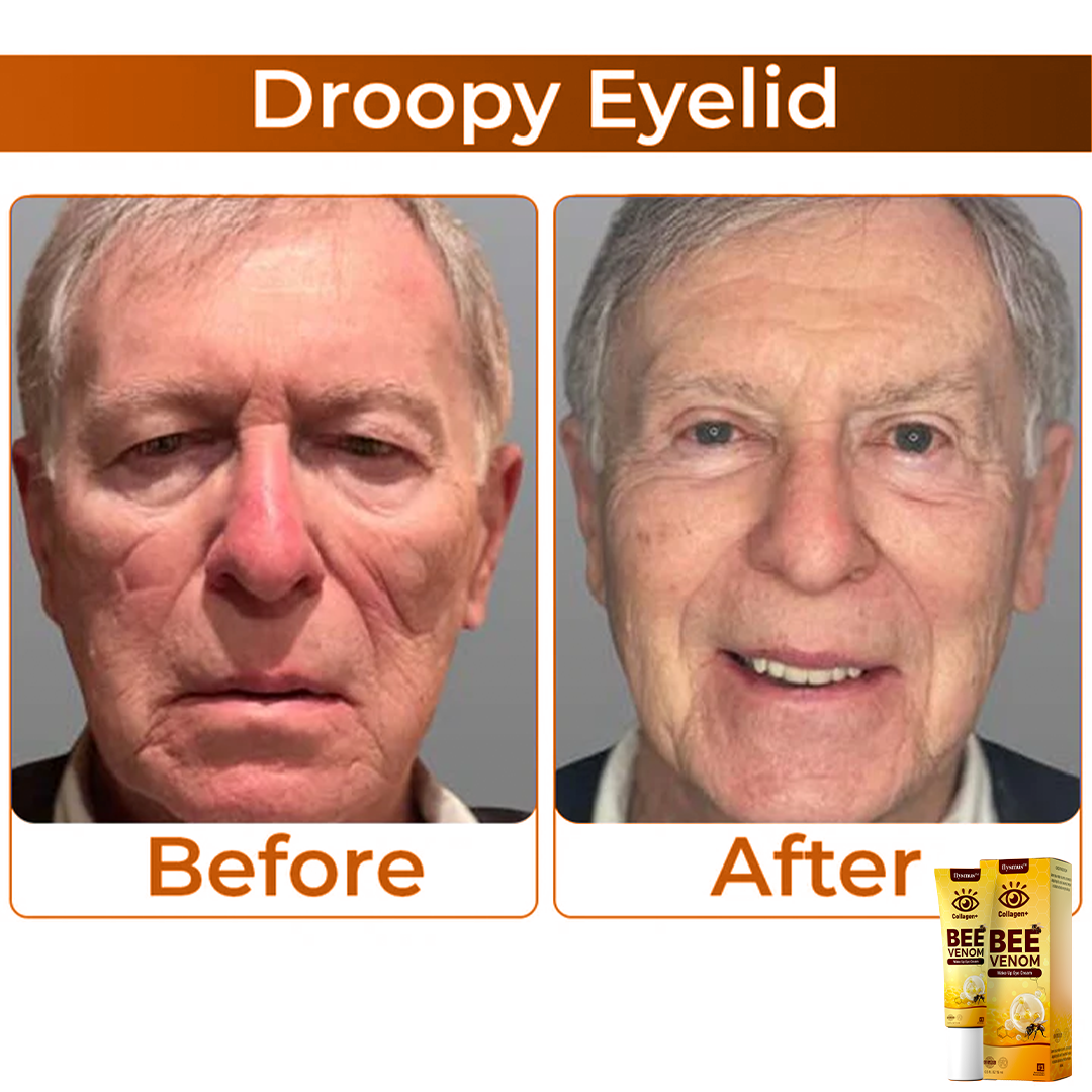 Frendorf | BeeVenom- Augencreme Mit Bienengift Für Strahlende Jugendlichkeit