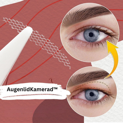 Frendorf | AugenlidKamerad Nahtloser Lift-Effekt