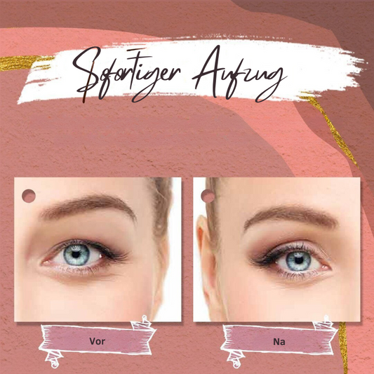 Frendorf | AugenlidKamerad Nahtloser Lift-Effekt