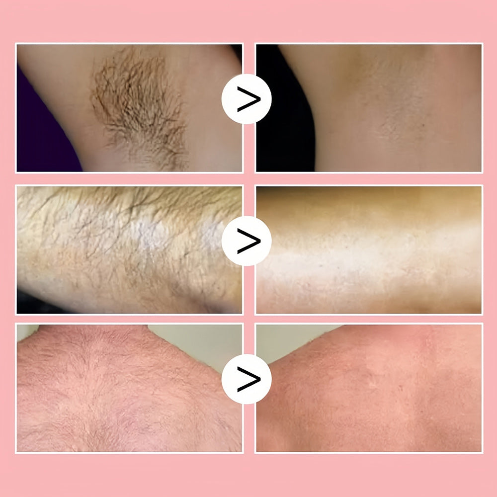 Frendorf | 1+1 GRATIS | 100ml Honey Mousse Hair Removal Spray – Für eine makellose und haarfreie Haut!