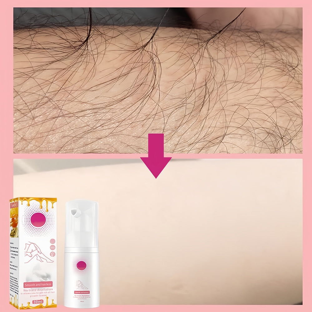 Frendorf | 1+1 GRATIS | 100ml Honey Mousse Hair Removal Spray – Für eine makellose und haarfreie Haut!