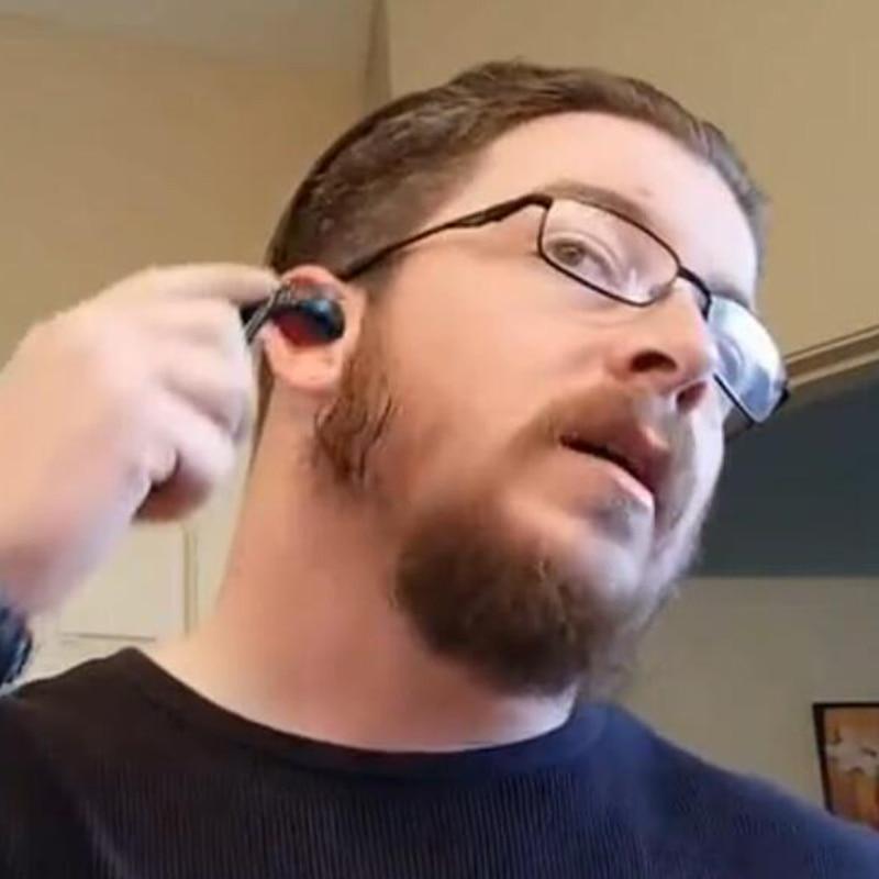 Frendorf | Premium Titan Mikronadel Derma Roller