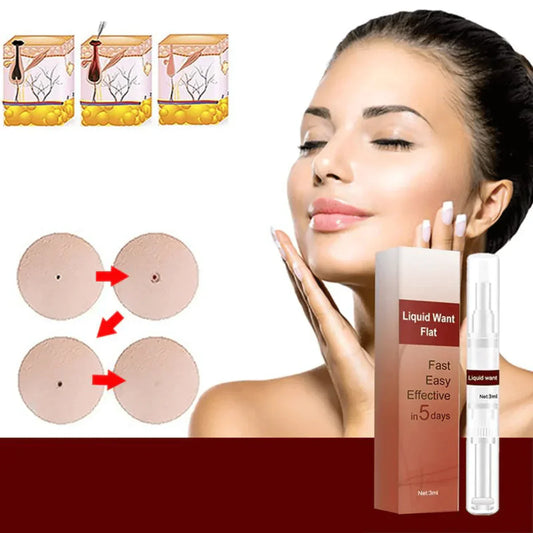 Frendorf |  SkinEase - Hartnäckige Flecken und Warzen entfernen