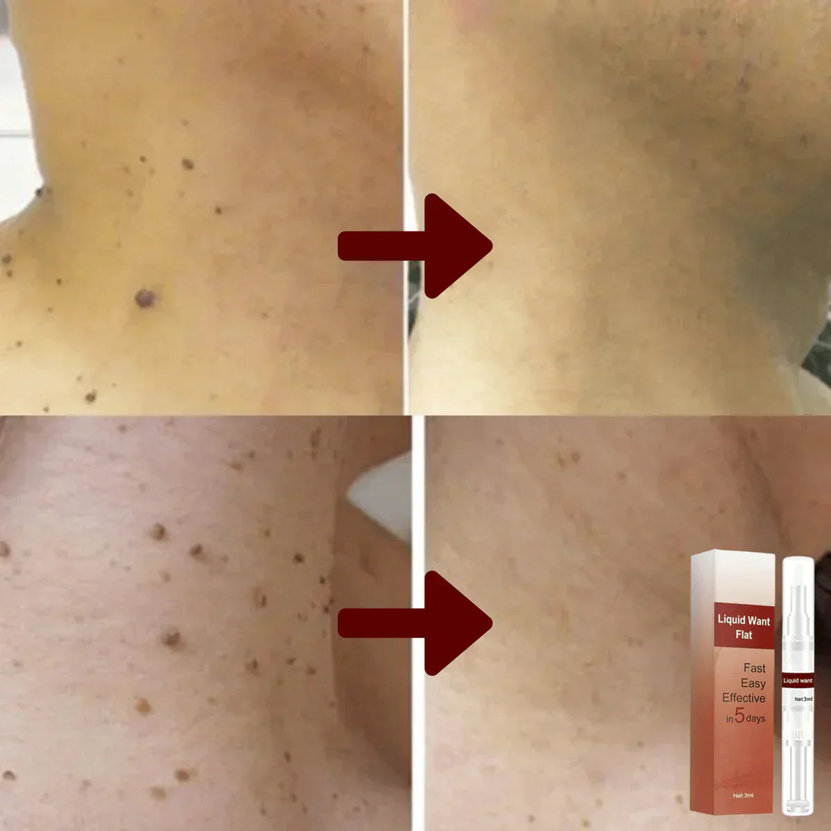 Frendorf |  WipeOff - Hartnäckige Flecken und Warzen entfernen