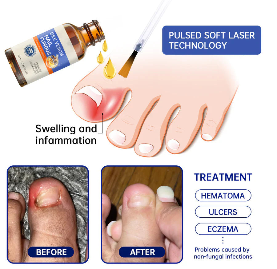 Frendorf | Aurelia – Serum zur Behandlung von Nagelpilz