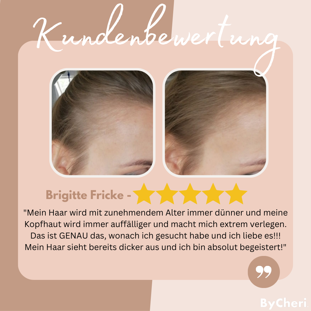 Frendorf | 1+1 GRATIS NUR TEMPORÄR | EasyBlend - Bye-Bye Haaransatz