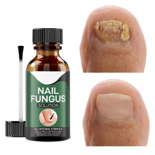 Frendorf | Auf Wiedersehen Fungus