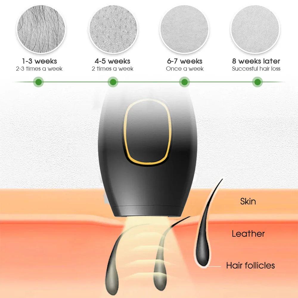 Frendorf | Bikini IPL 500.000 Flash Epilierer Impulse Permanent Laser Epilierer Schmerzlos Für Frauen Haar Entfernung Heimgebrauch Geräte