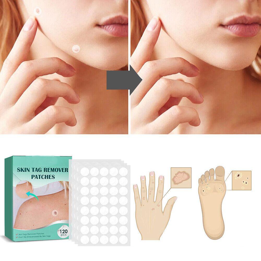 Frendorf | SkinClear - Pflaster zur Entfernung von Flecken und Warzen
