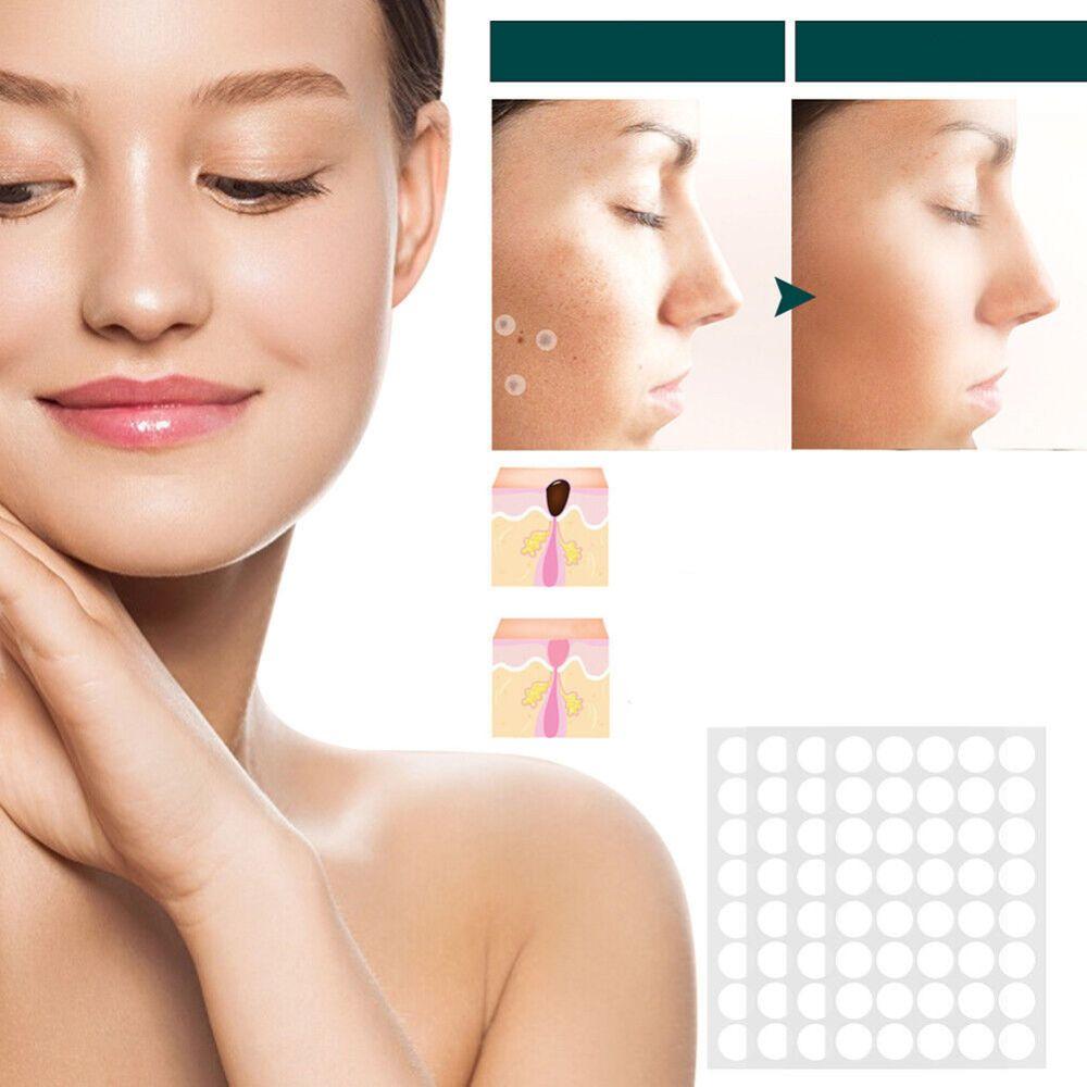 Frendorf | SkinClear - Pflaster zur Entfernung von Flecken und Warzen