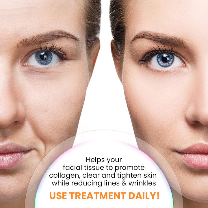 Frendorf | HydraLuxe | Koreanische Dermalayr-Technologie Löslicher Kollagenfilm