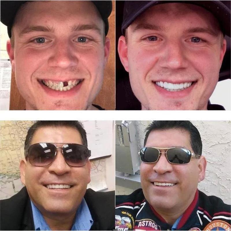 Frendorf |  Snap-On - Zahnersatz zum Einrasten