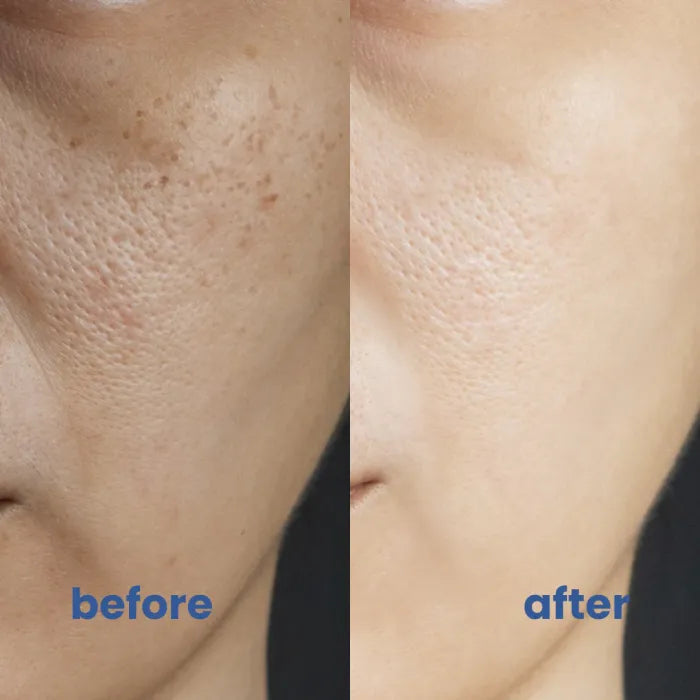 Frendorf | BrightSkin– Beruhigende Pflege für perfekte, strahlende Haut