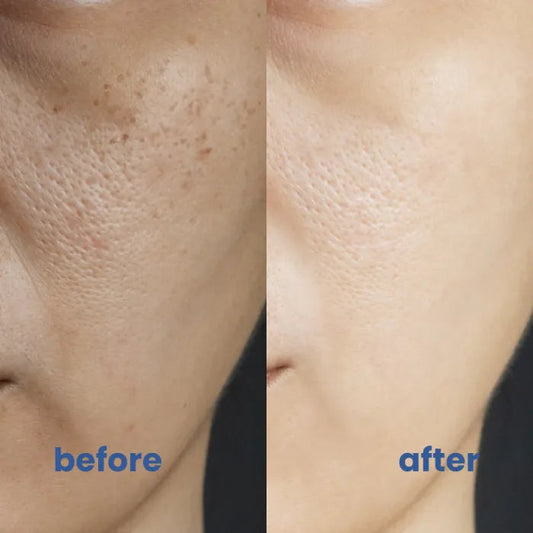 Frendorf | BrightSkin– Beruhigende Pflege für perfekte, strahlende Haut