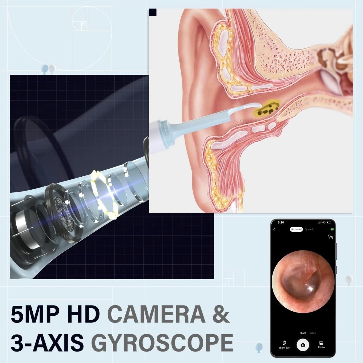 Frendorf | AURIVIEW – Smart-Ohrreiniger mit HD-Kamera