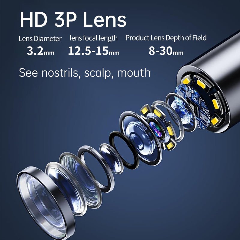 Frendorf | AURIVIEW – Smart-Ohrreiniger mit HD-Kamera