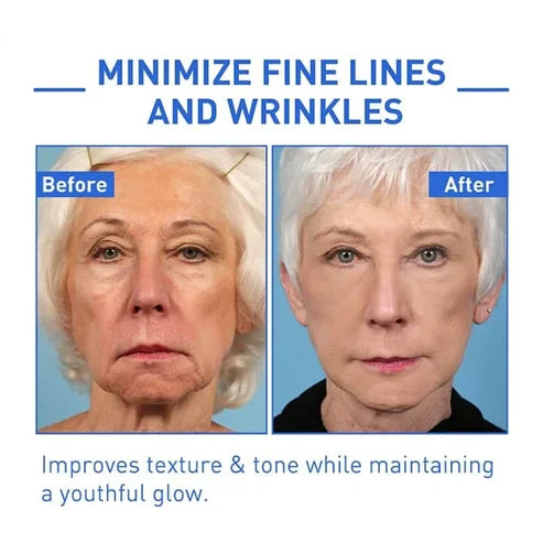 Frendorf | YouthRevive – Botox Anti-Aging Serum für Strahlende Haut