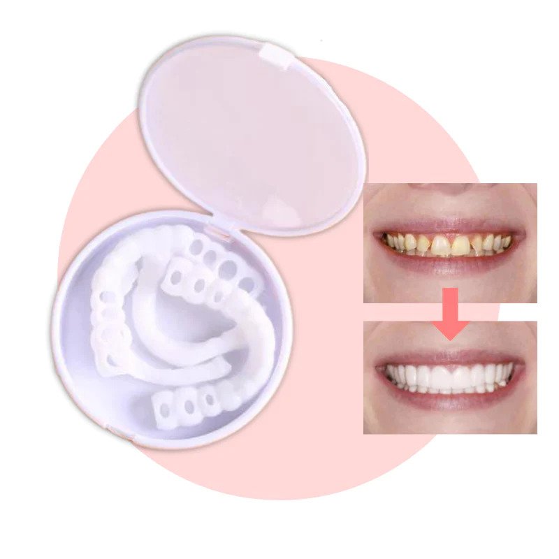 Frendorf | SmileSnap - Immer das perfekte Lächeln mit diesen Veneers