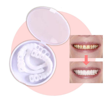 Frendorf | SmileSnap - Immer das perfekte Lächeln mit diesen Veneers