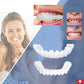 Frendorf | SmileSnap - Immer das perfekte Lächeln mit diesen Veneers