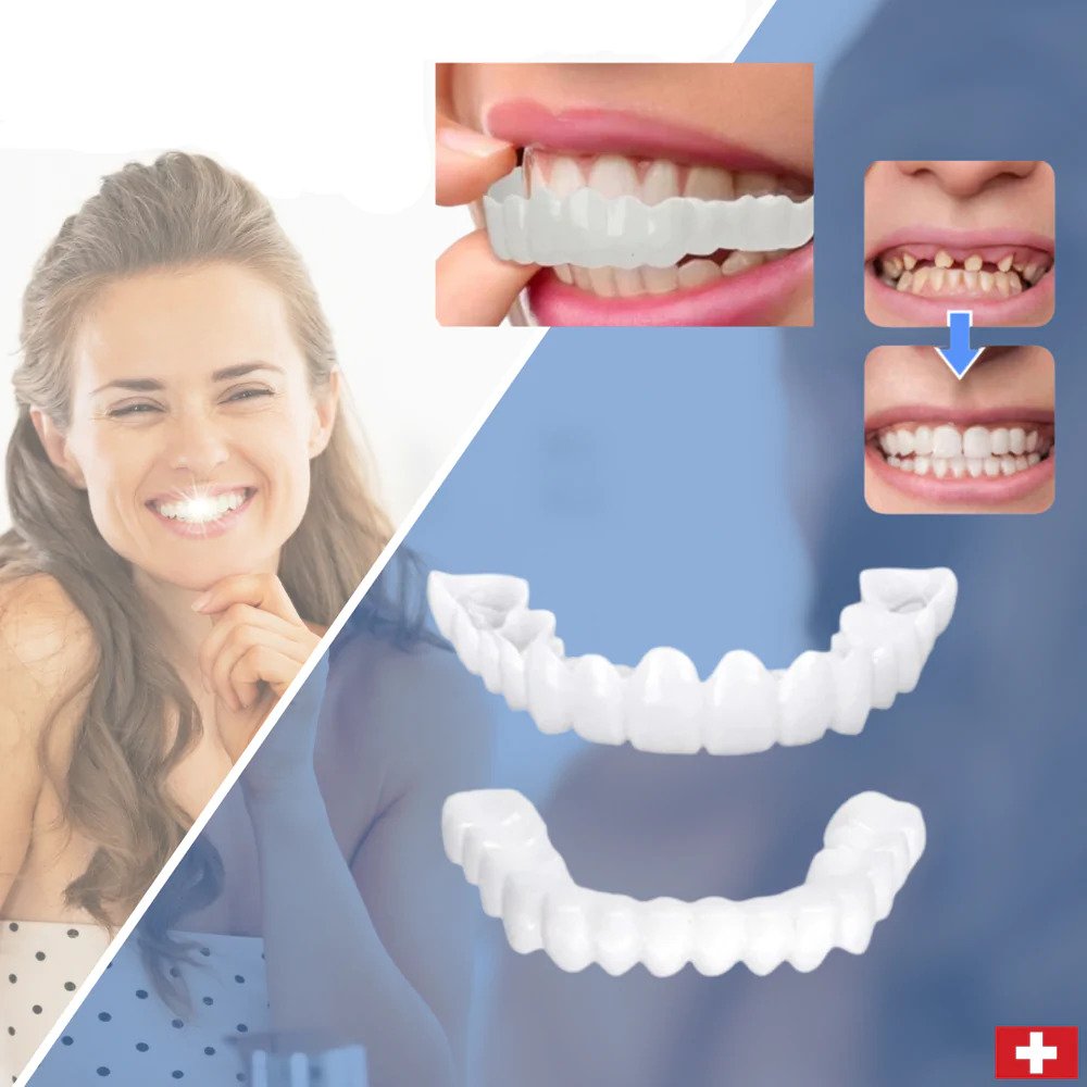 Frendorf | SmileSnap - Immer das perfekte Lächeln mit diesen Veneers