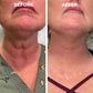 Frendorf | YouthRevive – Botox Anti-Aging Serum für Strahlende Haut