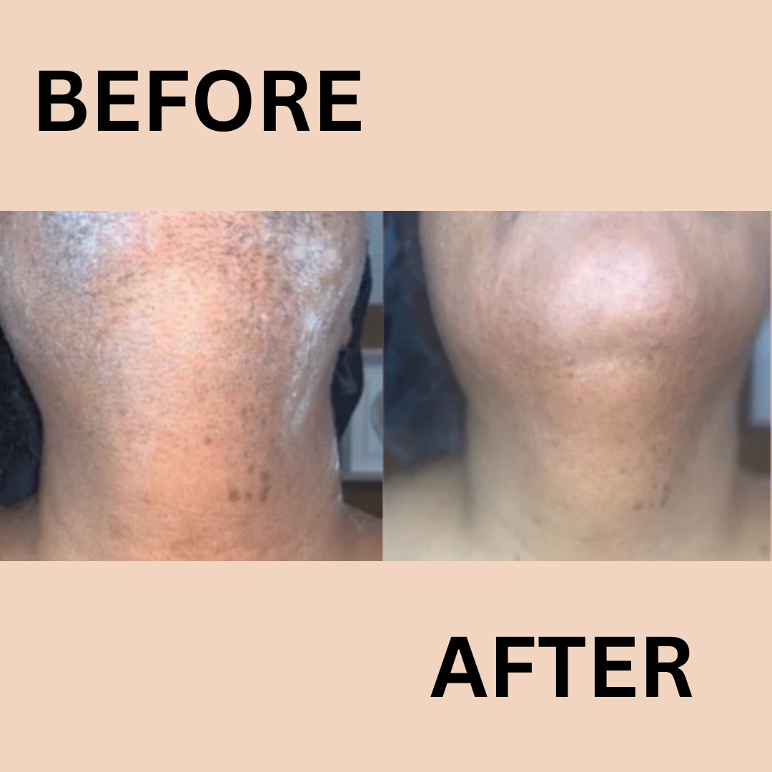 Frendorf | BareSmooth | Enthaarungscreme für Frauen