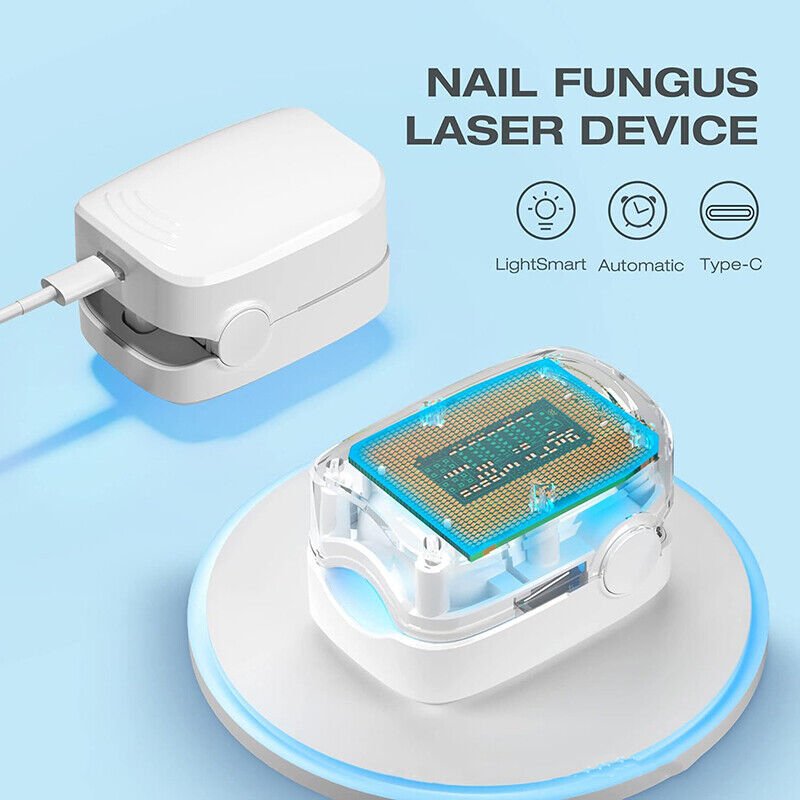 Frendorf | Lasergerät zur Nagelpilz-Reinigung – Revolutionäres, hocheffizientes Lichttherapiegerät von Expert für Erkrankungen der Zehennägel