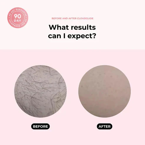 Frendorf | SoftTrim - Glatte Haut in Sekunden!