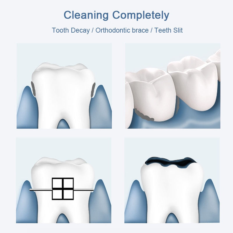 Frendorf | 2in1 Tragbarer Wasserhahn Zahnbürste Wasserzahnreiniger
