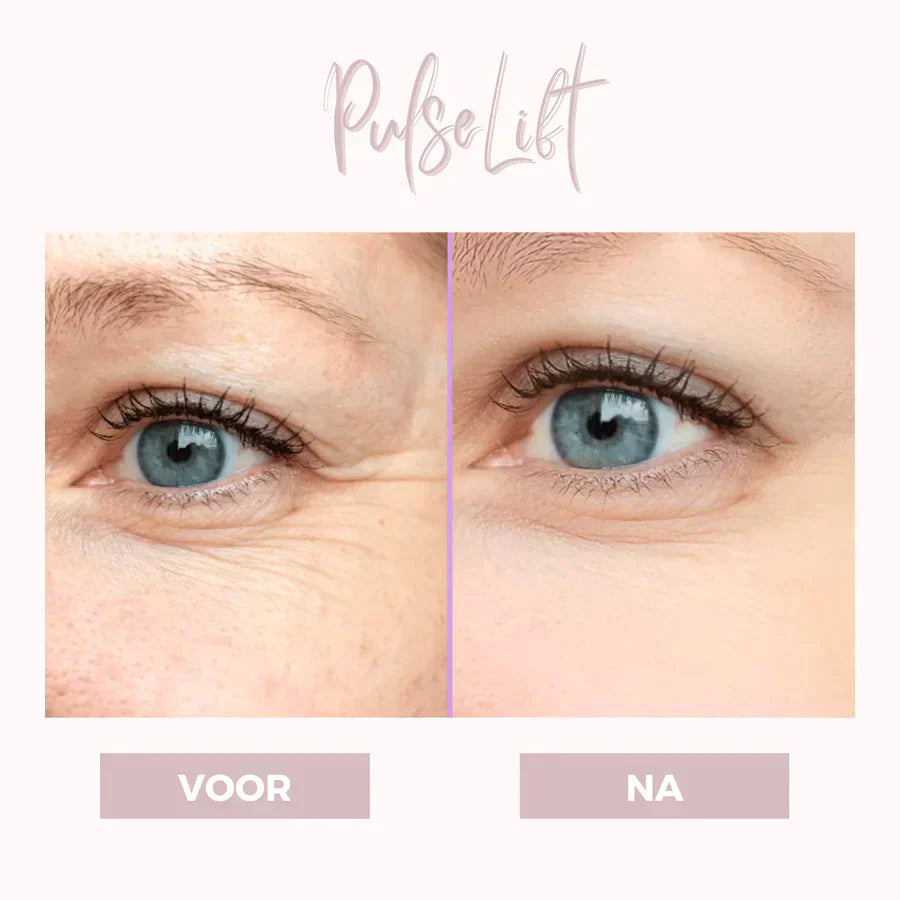 EyePat - Dermatologisches Augenlift-Gerät