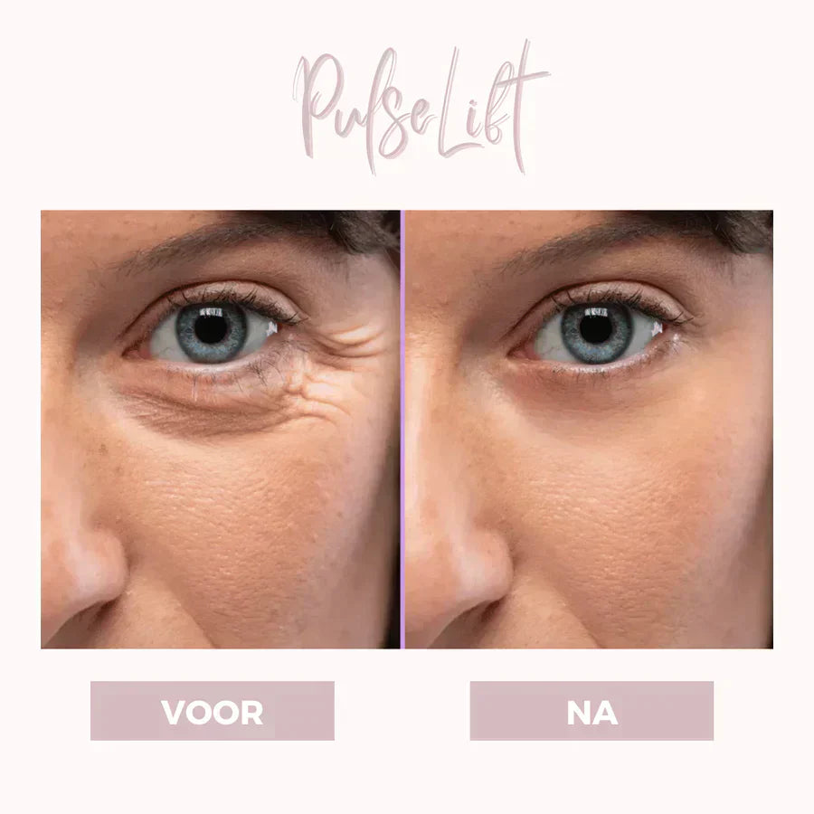 EyePat - Dermatologisches Augenlift-Gerät