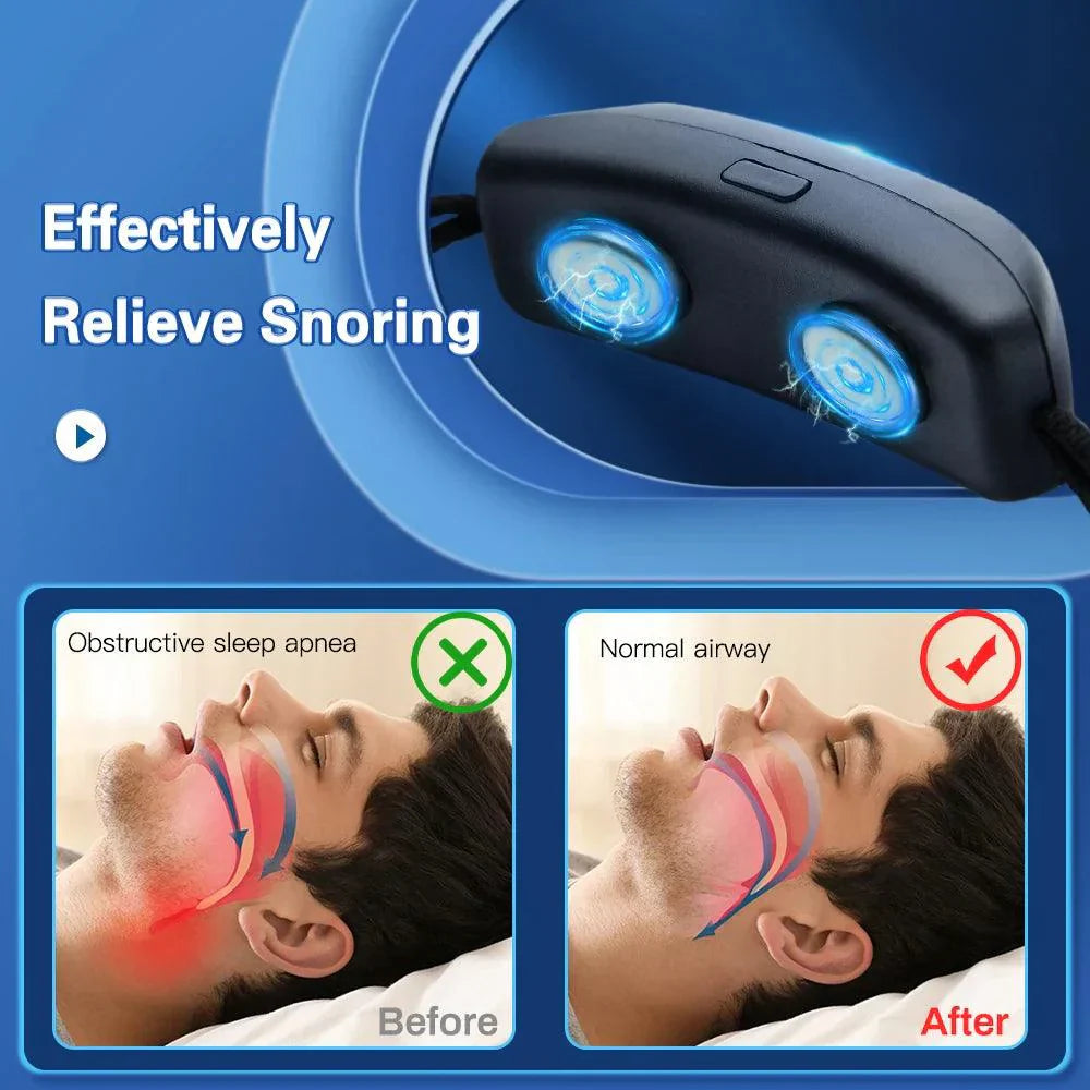 Frendorf | Smart Anti-Schnarch-Gerät EMS-Puls Stopp Schnarchen Tragbar Bequem Schlafen Gut Stopp Schnarchen Gesundheitsversorgung Schlafapnoe Hilfsmittel USB