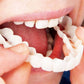 Frendorf | SmileSnap - Immer das perfekte Lächeln mit diesen Veneers