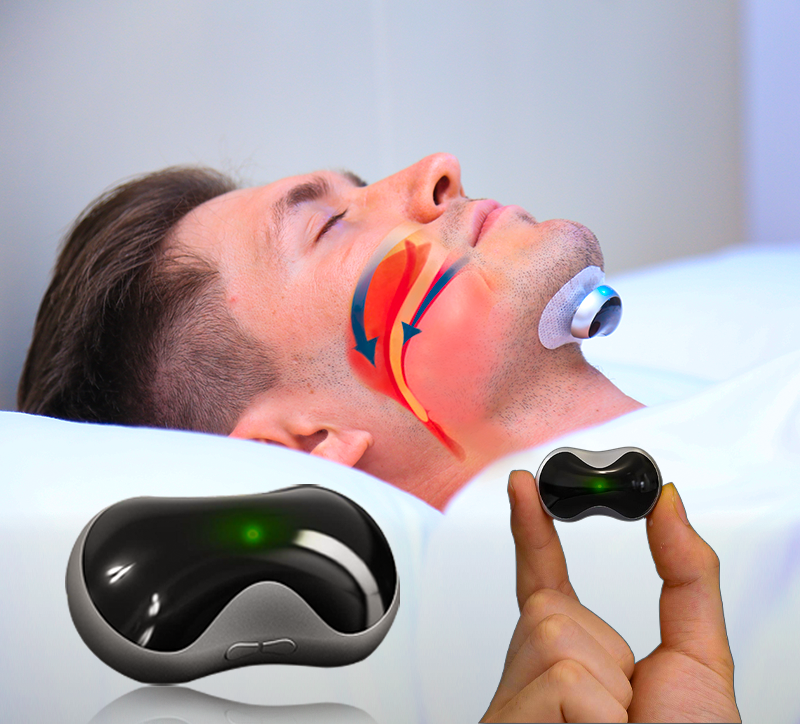 Frendorf | SilentDream - Fortschrittliches Anti-Schnarch Puls-Gerät - Effektive Schnarchlösung