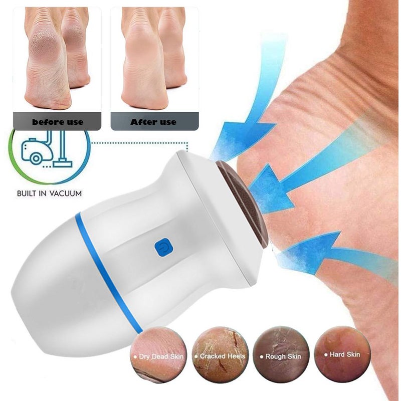 Frendorf | BabyFoot | PROFESSIONELLE PEDIKÜRE VON ZU HAUSE AUS!