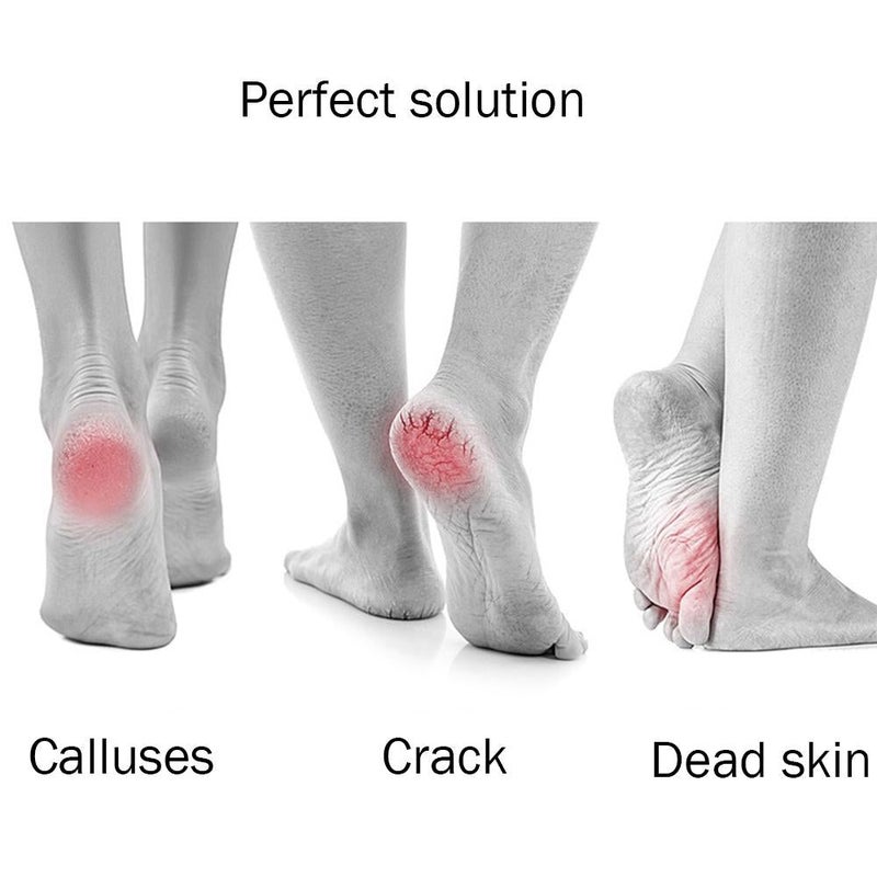 Frendorf | BabyFoot | PROFESSIONELLE PEDIKÜRE VON ZU HAUSE AUS!