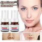 Frendorf | SpotLuxe – Serum zur Entfernung von Dunklen Flecken
