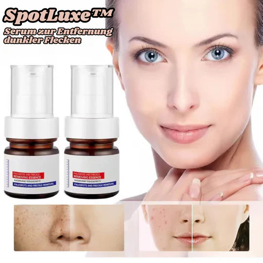 Frendorf | SpotLuxe – Serum zur Entfernung von Dunklen Flecken