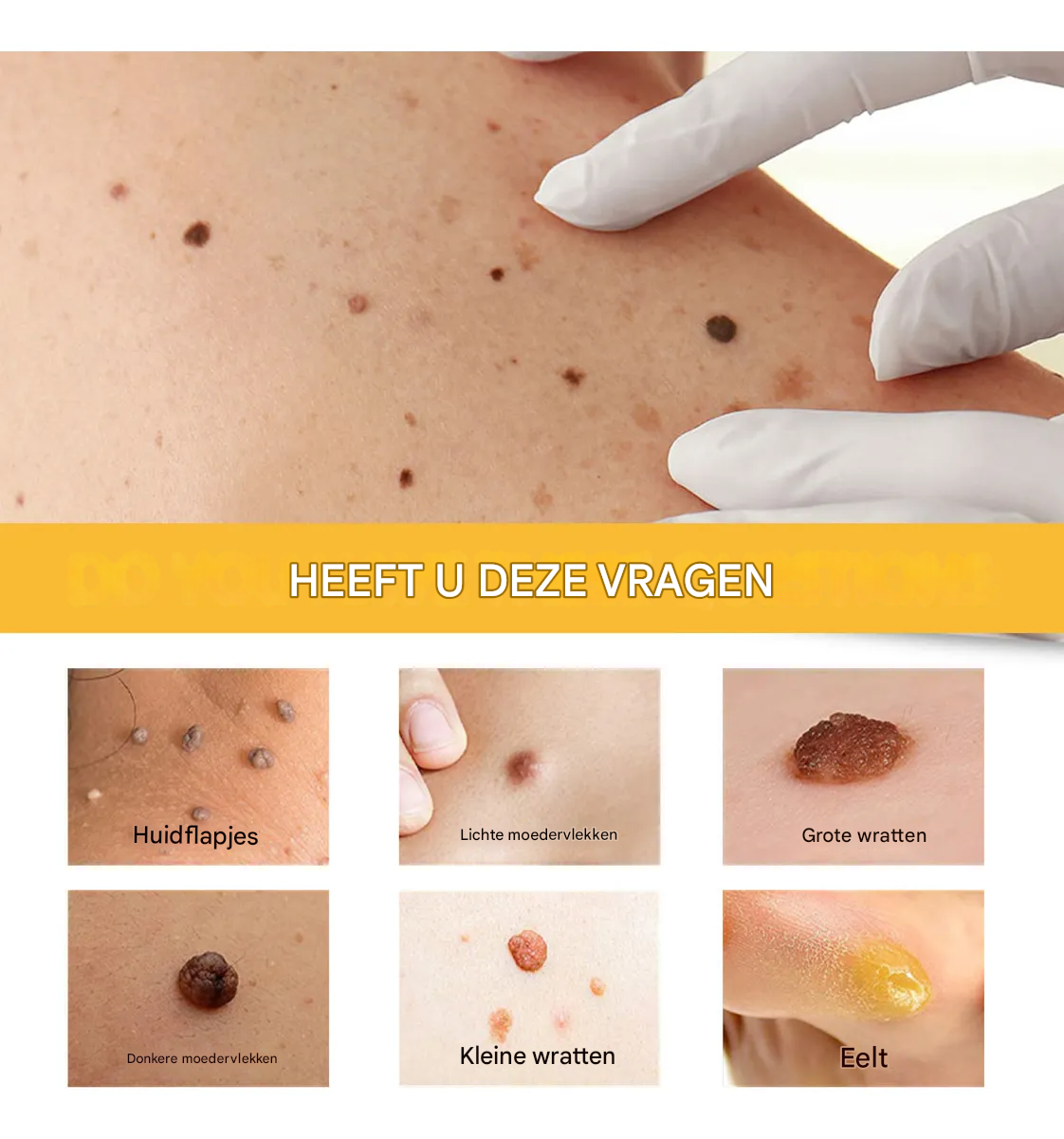 Frendorf | BeeNaturale– Entfernt Hautflapjes und Flecken sanft und effektiv