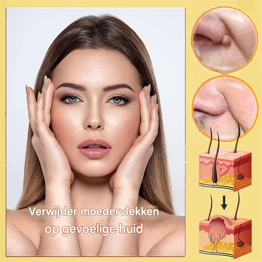 Frendorf | BeeNaturale– Entfernt Hautflapjes und Flecken sanft und effektiv